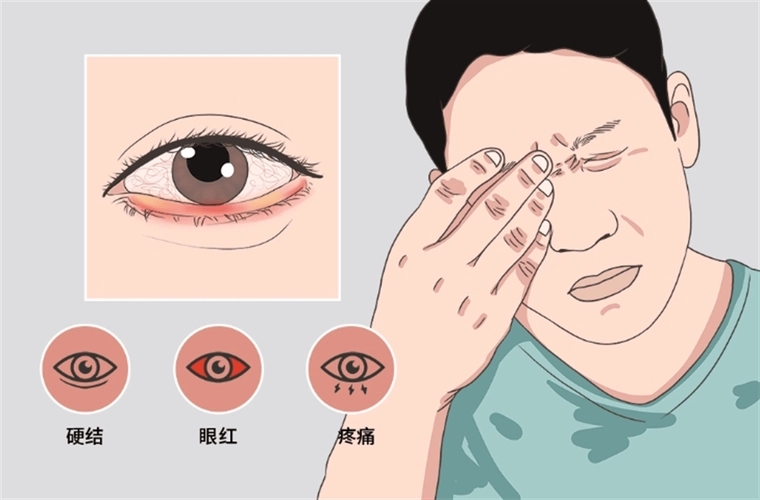 慢性眼角膜炎怎样治疗